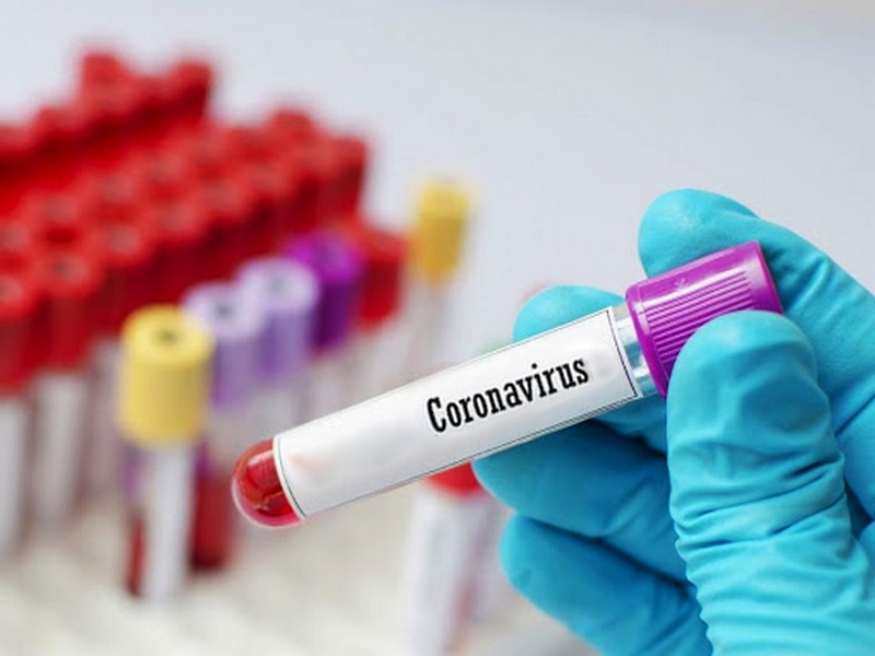 koronavirus.1